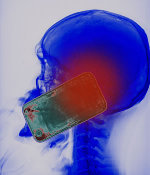Colour X-ray showing the head of a man using a smartphone © VOISIN/PHANIE/SCIENCE PHOTO LIBRARY